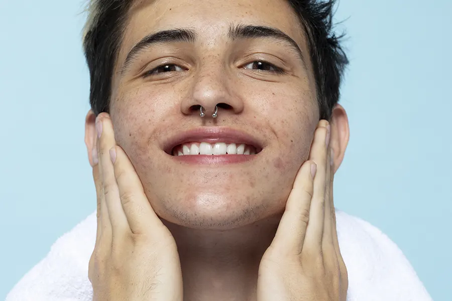 Un aiuto contro l’acne